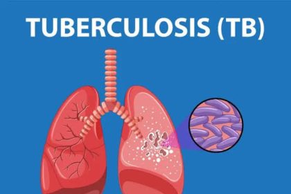Nigeria Strengthens Commitment to Rid Off Tuberculosis Mediaage NG Nigeria has strengthened its commitment to get rid of tuberculosis (TB), listing several interventions to boost the country's TB response.