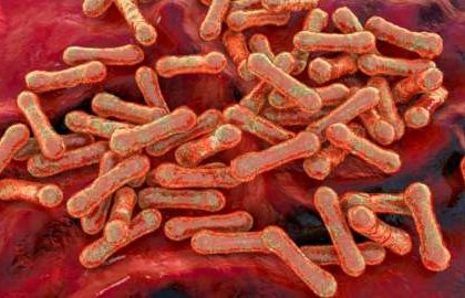 Outbreak of Deadly Disease Hits Nigerian Capital Mediaage NG The Nigerian Centre for Disease Control (NCDC) has announced an outbreak of a highly contagious infection, diphtheria in Abuja, its capital. This comes after the death of a four-year-old.