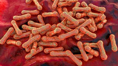 Outbreak of Deadly Disease Hits Nigerian Capital Mediaage NG The Nigerian Centre for Disease Control (NCDC) has announced an outbreak of a highly contagious infection, diphtheria in Abuja, its capital. This comes after the death of a four-year-old.