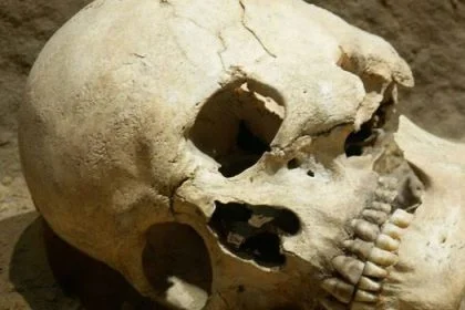 Five Nigerians Jailed For Exhuming Human Skull Mediaage NG Minna, Niger State - October 17 - Mediaage NG News - Five men in Niger State, Nigeria, have been jailed for 12 years each, after they were convicted of exhuming a human skull for rituals that would make them rich.